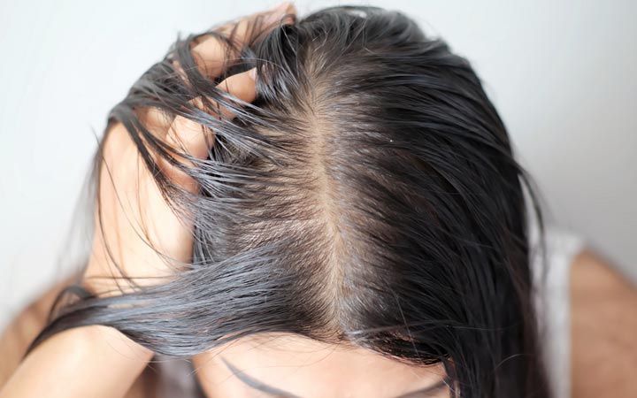 How to Manage Greasy Hair