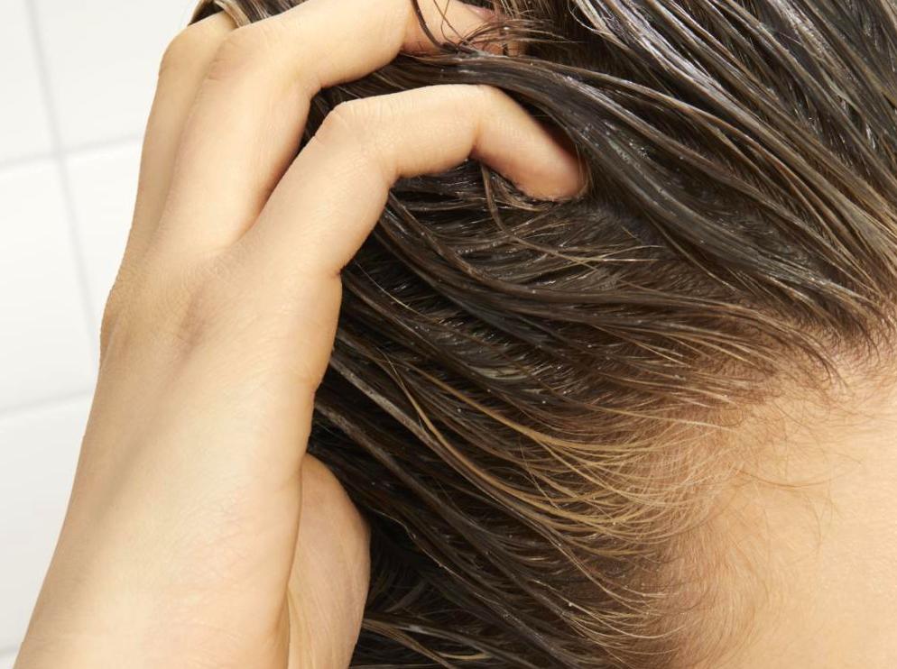 The Vital Role of a Healthy Scalp