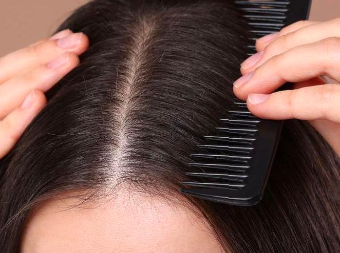 Understanding the Importance of Scalp Care