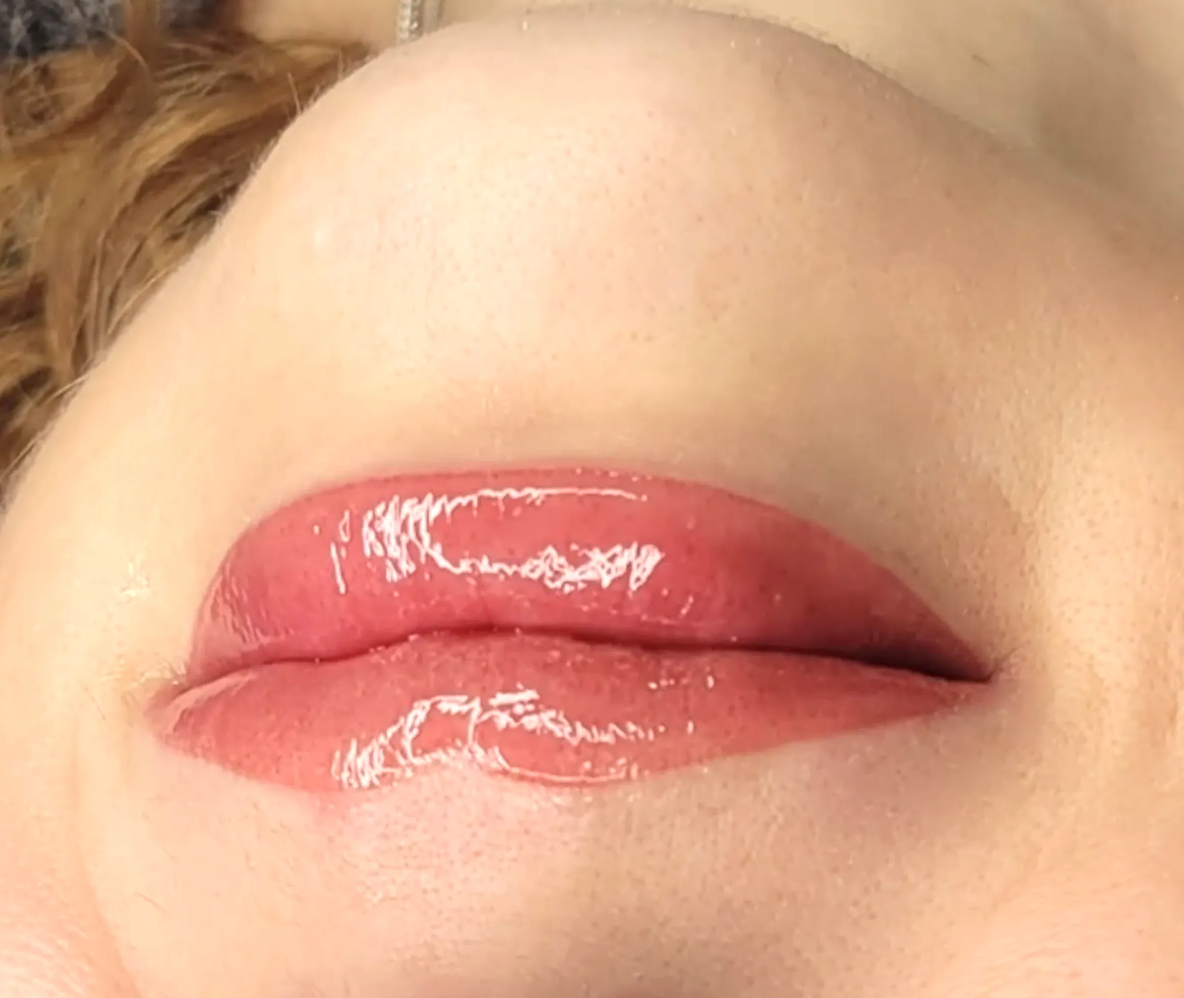 Is It Possible to Reverse Lip Blush?