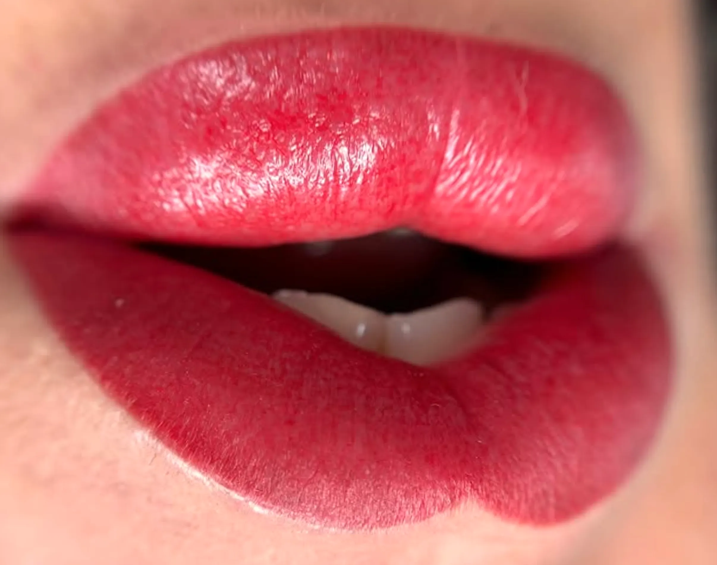 permanent makeup removal