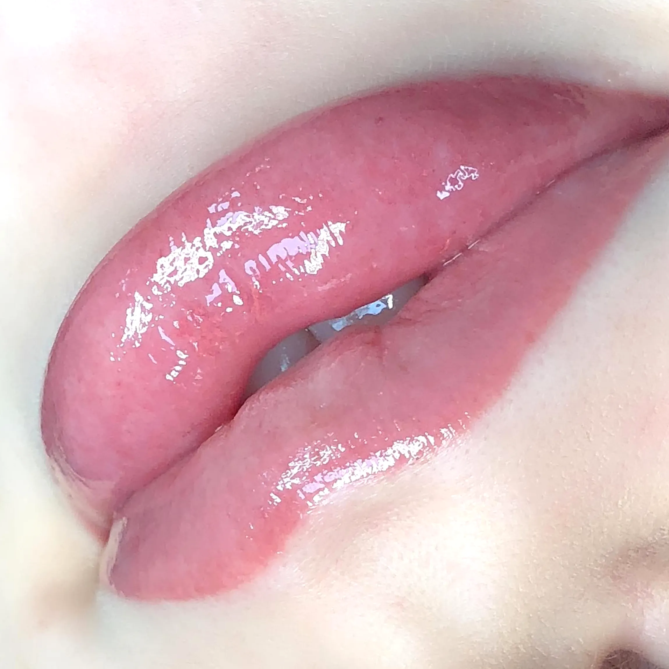 saline vs laser removal