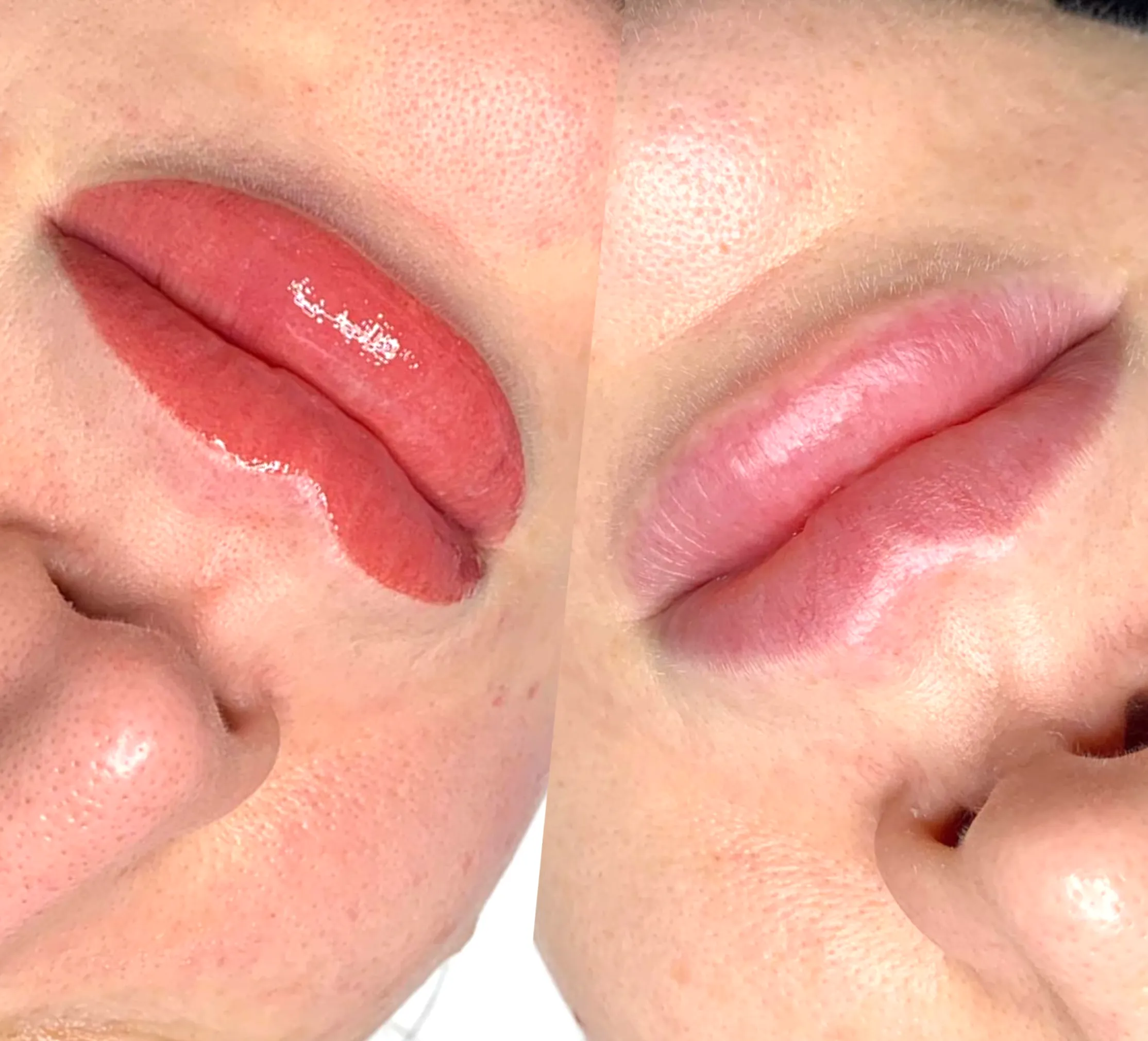lip tattoo correction