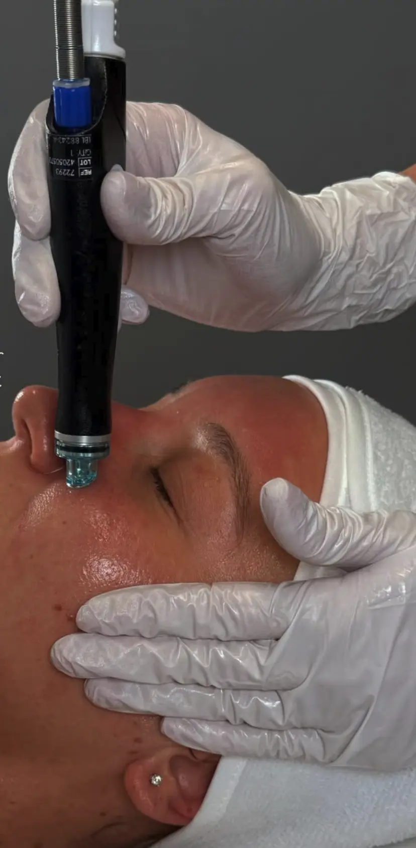 hydrafacial brisbane city