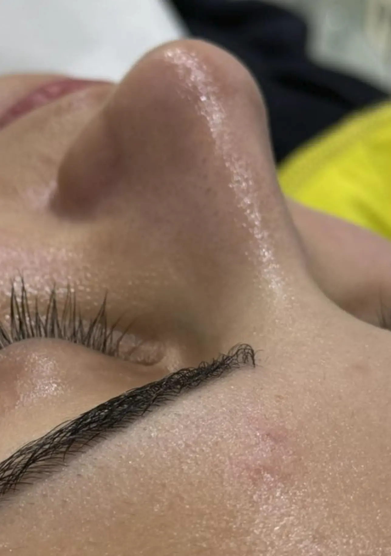 hydrafacial special brisbane